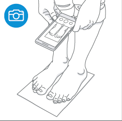 리앤양 발측정법 7번