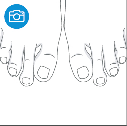 리앤양 발측정법 8번