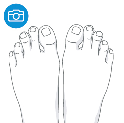 리앤양 발측정법 9번