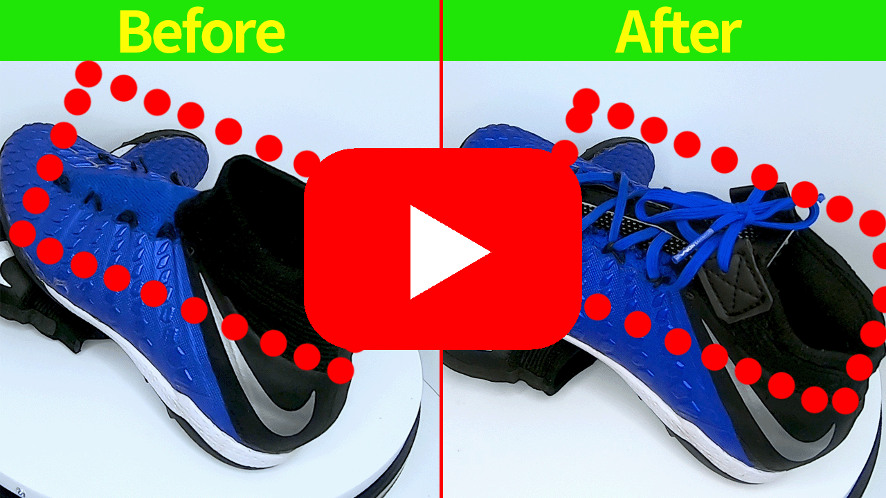 리앤양 발목 제거 후 베라 장착 유튜브 영상 1번